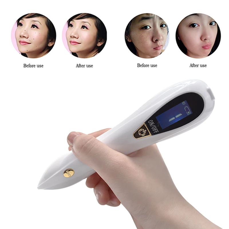 

Laser Mole Tattoo Removal Machine LCD Display Dark Spot Pen Facial Beauty Freckle Tag Wart Skin Care Salon Home Beauty Device