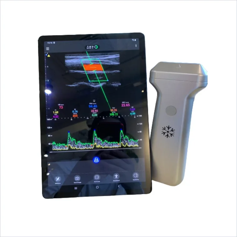 Мини беспроводной портативный ультразвуковой датчик выпуклый преобразователь