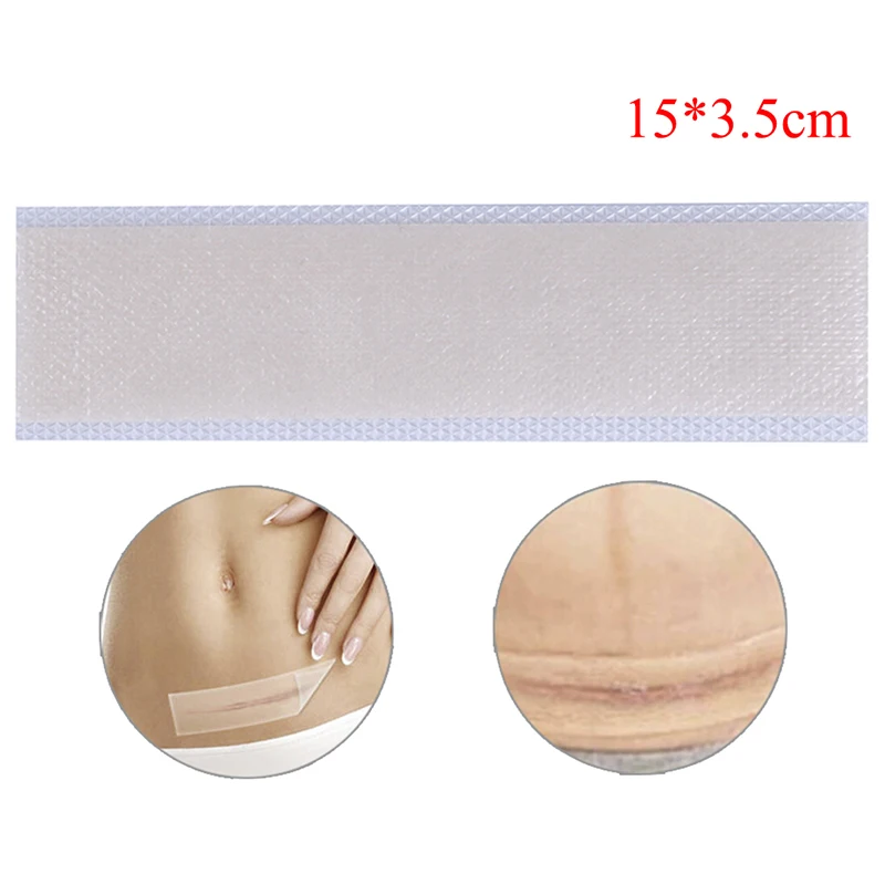 

1PC 0.4mm Silicone Scar Removal Patch Remove Trauma Burn Scar Sheet Skin Repair Acne Scar Removal Therapy Patch Treatment