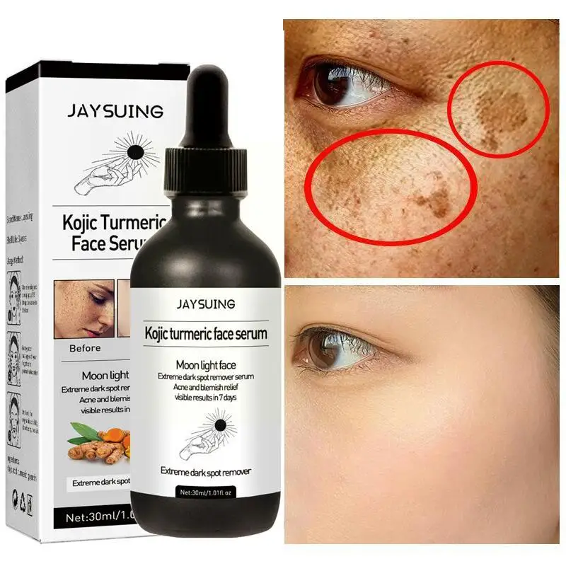 

Turmeric Whitening Freckles Face Serum Remove Dark Essence Acne Anti-aging Melasma Spots Scar Lighten Brighten F0L4