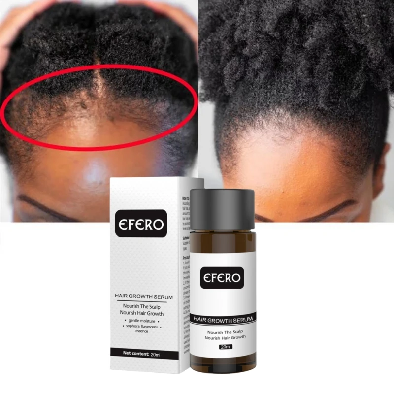 

Hair Growth Essence Oil for Black Women Anti Hair Loss Fast Regrowth Thicken Oils Treat Baldness Prevent Thinning Dry Hair Care