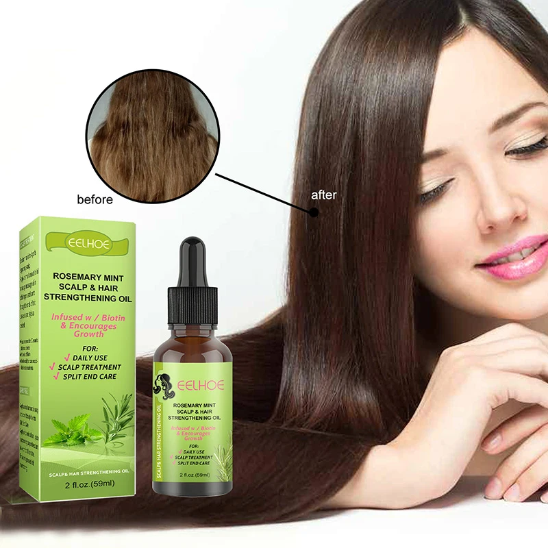 

Средство для роста волос, против выпадения волос, эфирное масло розмарина, средство для лечения волос с интенсивным маслом