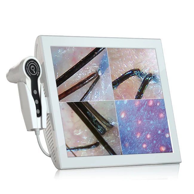 Портативный анализатор кожи анализа пор детектор волосяных фолликулов SA-S04A