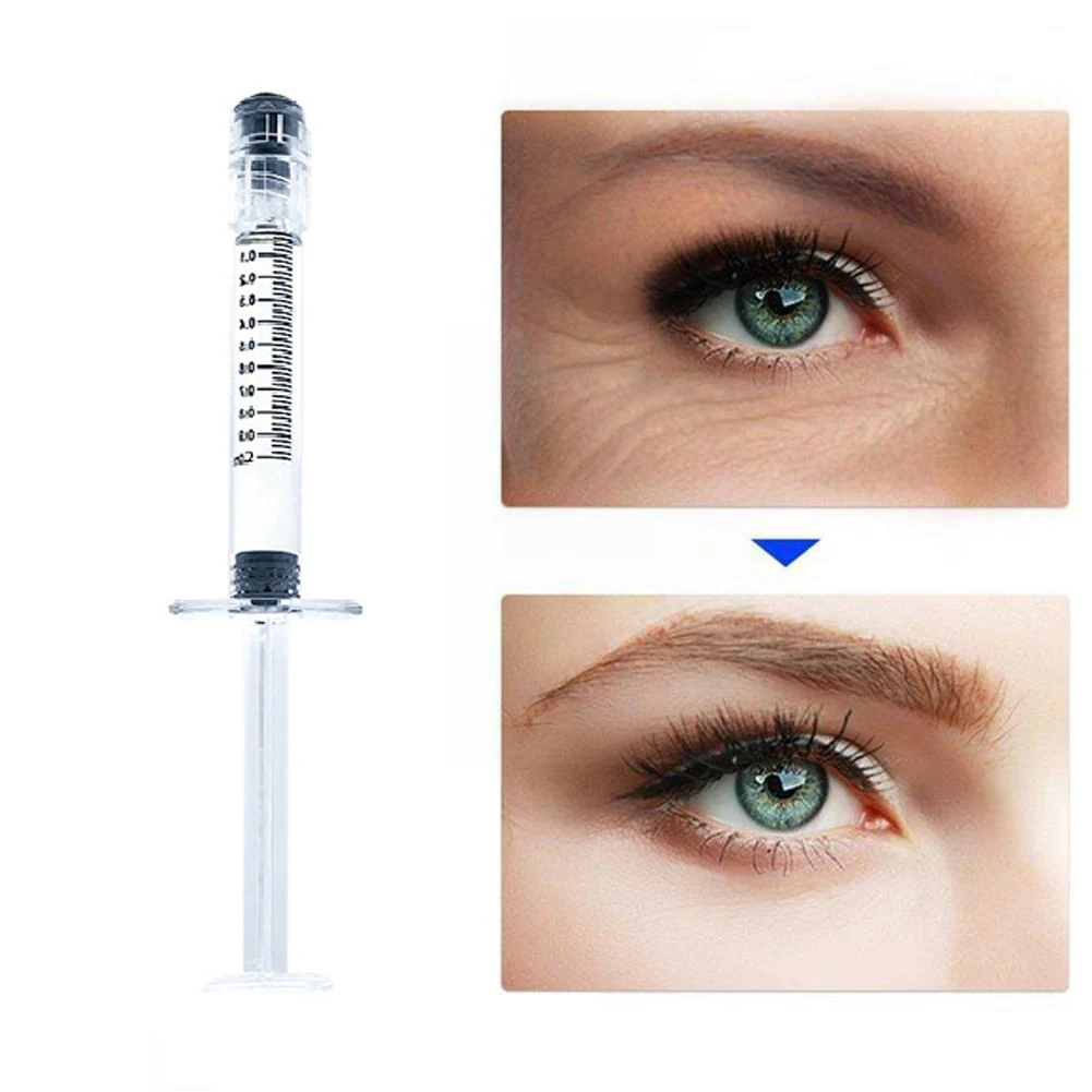 

2ml Molecule Hyaluronic Acid Filler Lip/nose/cheek Hyaluronic Acid Needle Firming Skin Liquid Anti Wrinkle Anti Aging Collagen