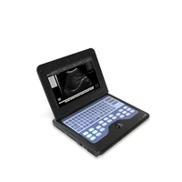 portable ultrasound system laptop ultrasound ce approved ultrasound machine