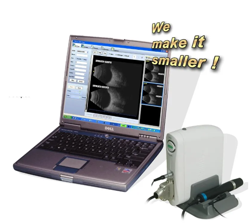 

Top quality Newest Ophthalmic Machine AB Scan Portable Ultrasound Scanner SW-2100