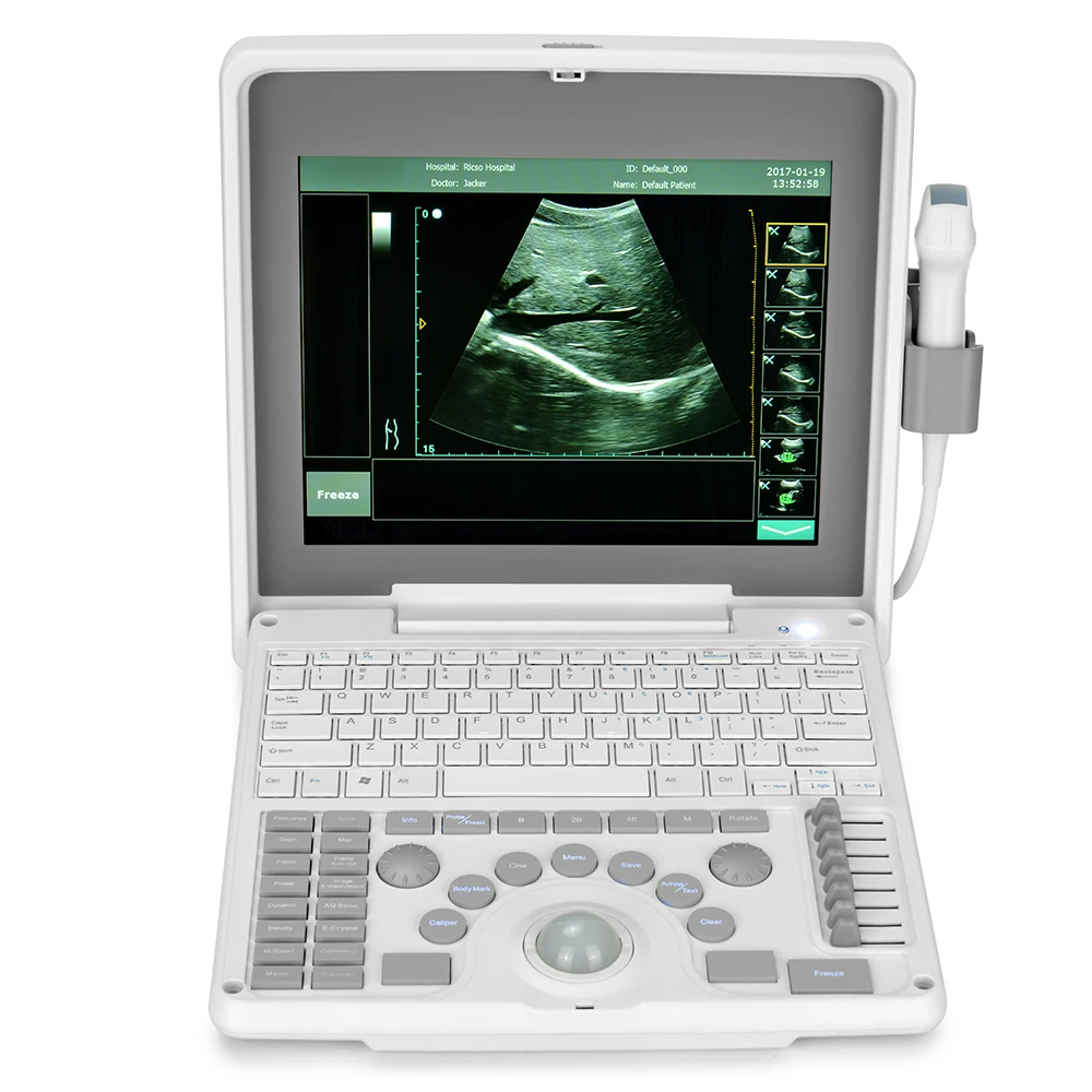 

SINOHERO Portable Ultrasound Scanner Ultrasound Portable Vet Handheld Ultrasound Scanner