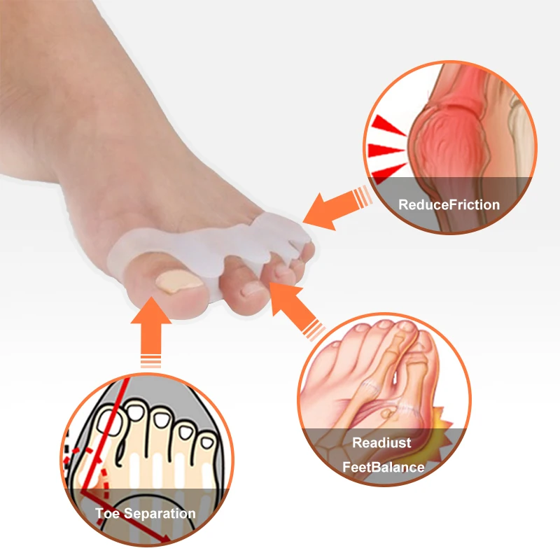 

Силиконовые разделители для пальцев, растяжки, выпрямитель, защита от большого пальца, инструмент для ухода за ногами
