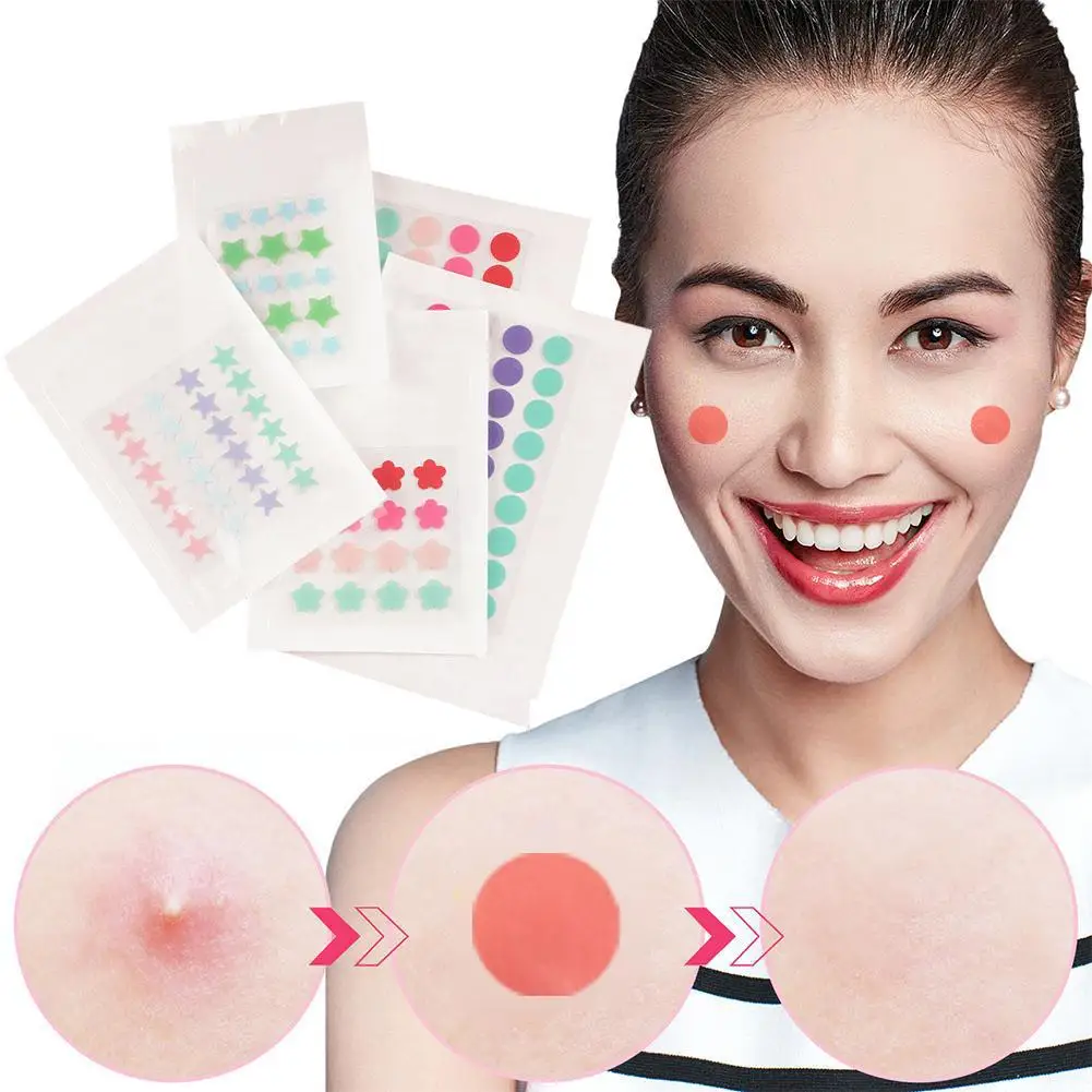 

Acne Patch Waterproof Acne Pimple Treatment Stickers Blackhead Spot Freckle Skin Scare Face Removal Facial Care Mask Concea Z2V3
