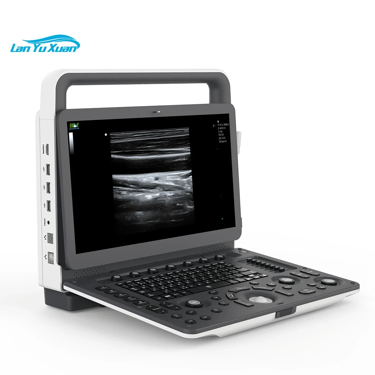 Рисунок 4 - Портативный ультразвуковой допплер