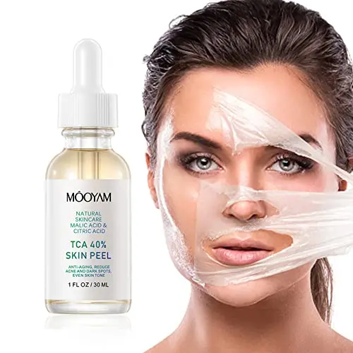 Facial Peel Chemical Peel 40 Percent Peeling Serum Peeling for Face Facial Exfoliant for Dark Skin  Dark Spots Acne Blemish-30ml
