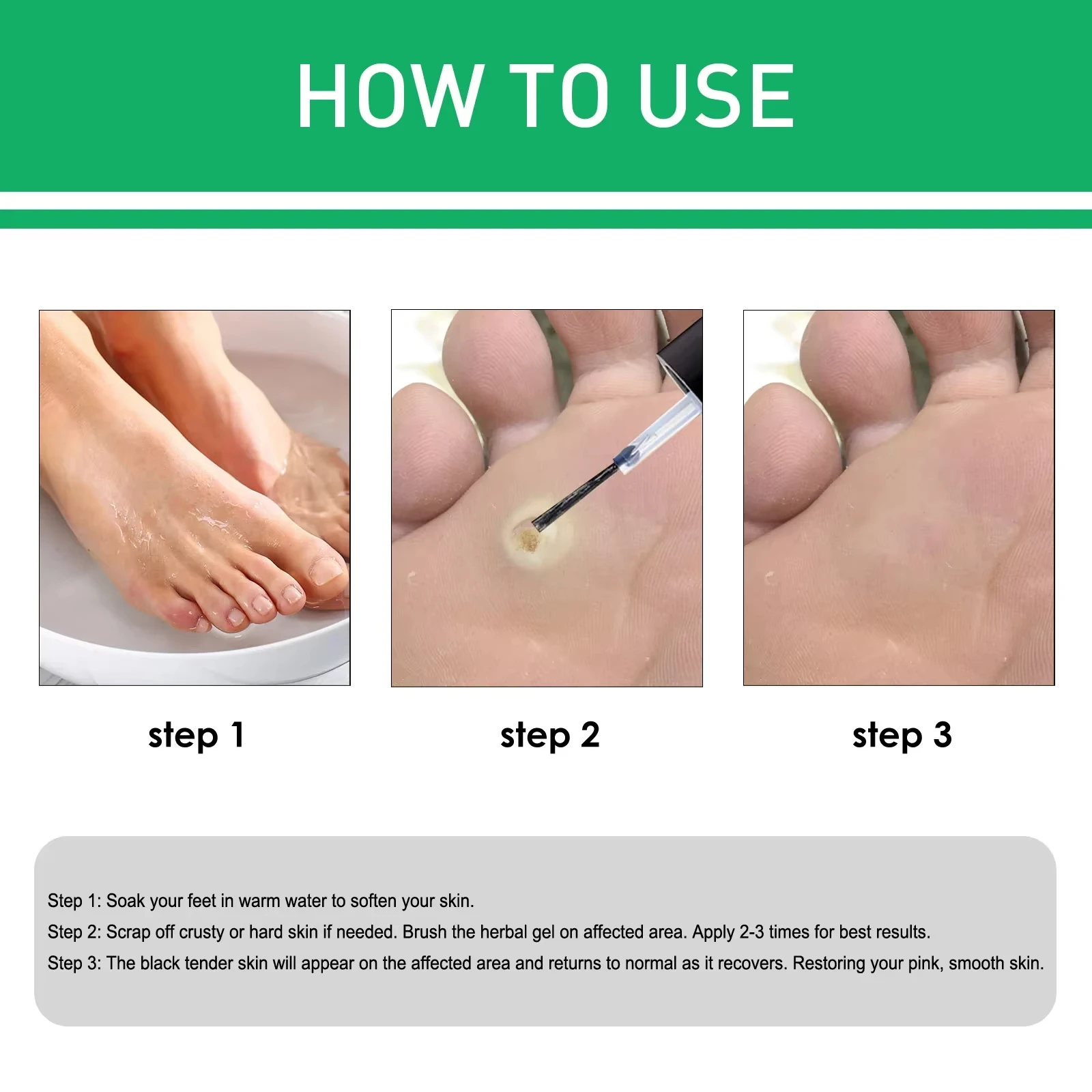10ml Foot Corn Remover Chicken Eye Skin Infection Treatment Solution Dead Scab Removal Tool Health발톱무좀