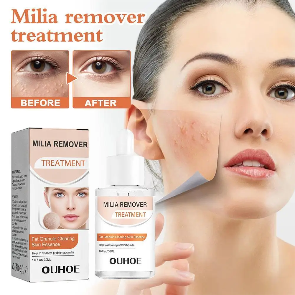 

30ml Milia Clearing Essence Remover Essence Fat Granule Skin Clearing Serum Under Eye Milia Repair Essence Anti Aging Anti Acne