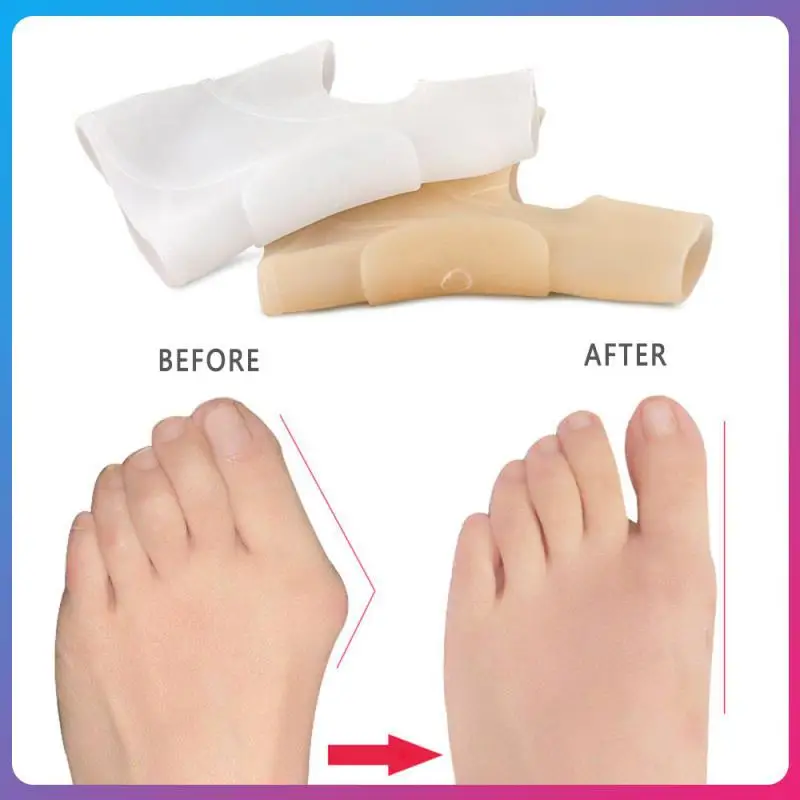 

Silicone Gel Big Toe Separator Spreader Eases Foot Pain Foot Hallux Valgus Correction Guard Cushion Concealer Thumb Insoles