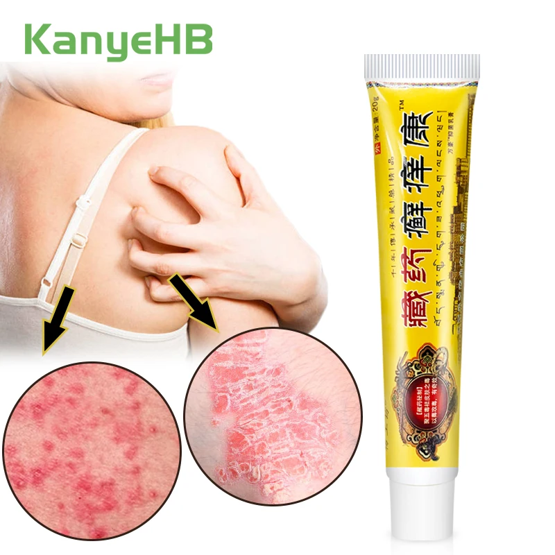 

1 шт. крем от псориаза, антибактериальная мазь для кожи, снятие зуда, экзема, сыпь, уртрия, дескуация, Лечебный крем для грибка S050