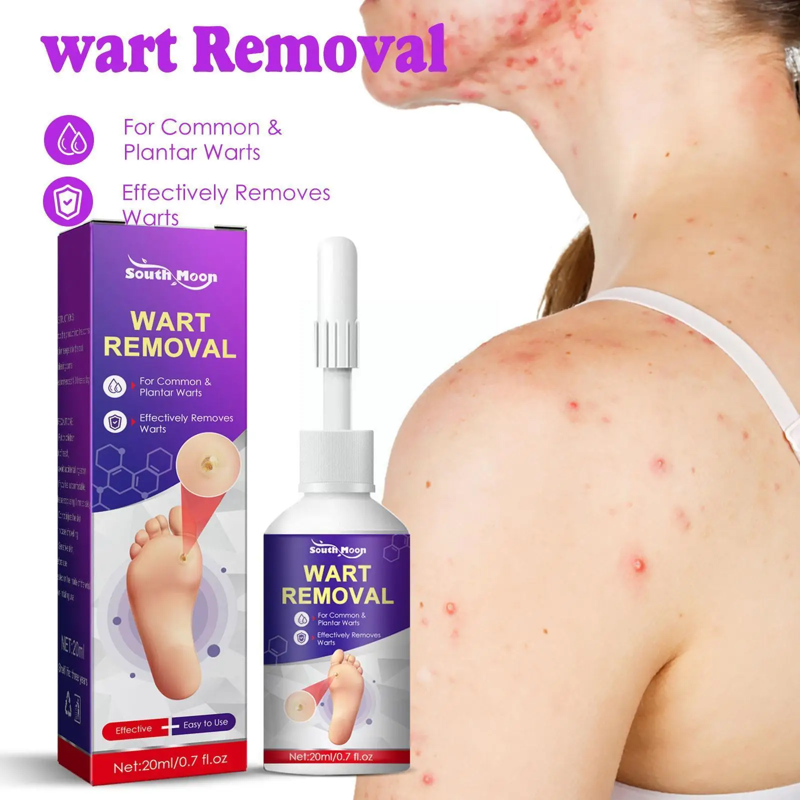 

20ml Skin Tag Removal Treatment Liquid Fast Wart Removal Anti Acne Treatment Spot Corn Foot Lotion G0l4