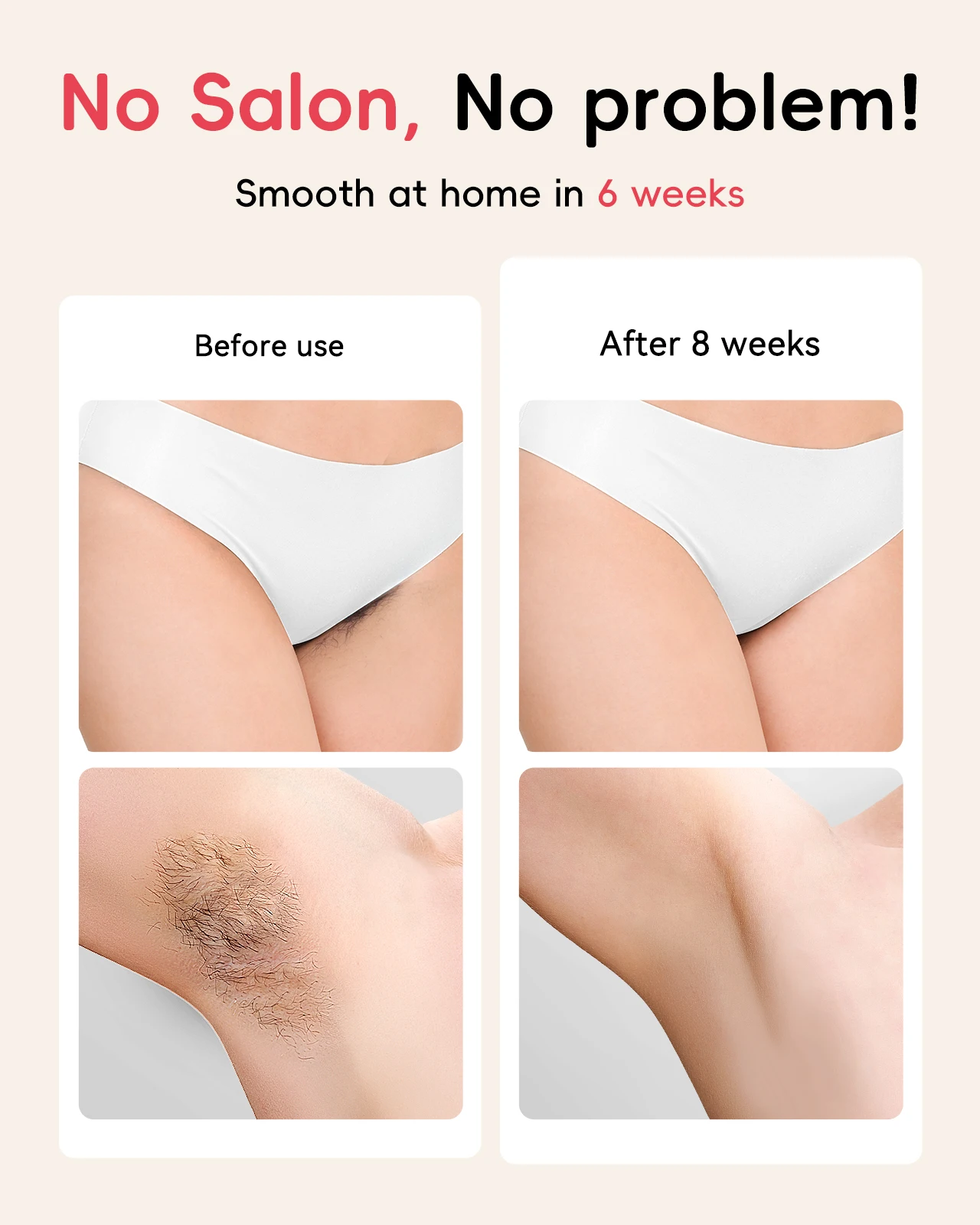 Лазерный эпилятор IPL 22J Unlimted IGBT 5 2 см2