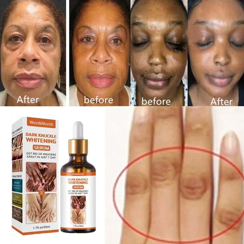 

Efficient Whitening Armpit Knuckle Knee Black Skin Essential Oil Private Parts Peach Soap BrightenDeep Cleaning Skin Care Set