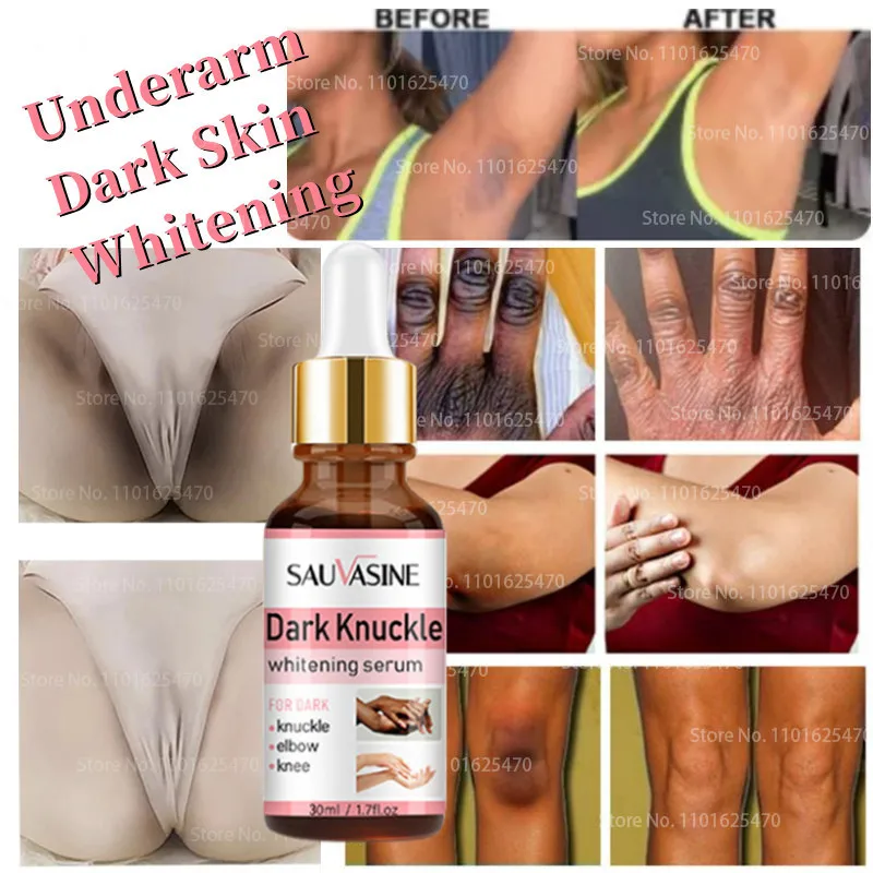 7 Days Skin lightening Serun Get Rid of Black Knuckles Whitening Removal Underarm Dark Skin Armpit  Elbow Knee Eraser Care Oil