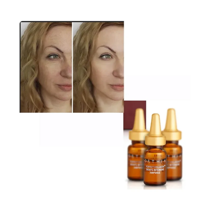 

Korea Type A 100/200 Unit Beauty Anti Wrinkles Face Lift Products Bot Nabo M Skin Care For Vip