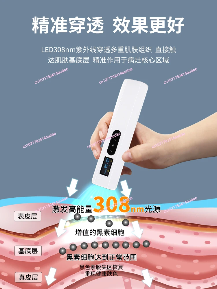 Медицинское устройство для фототерапии vitiligo домашнее лазерной терапии с