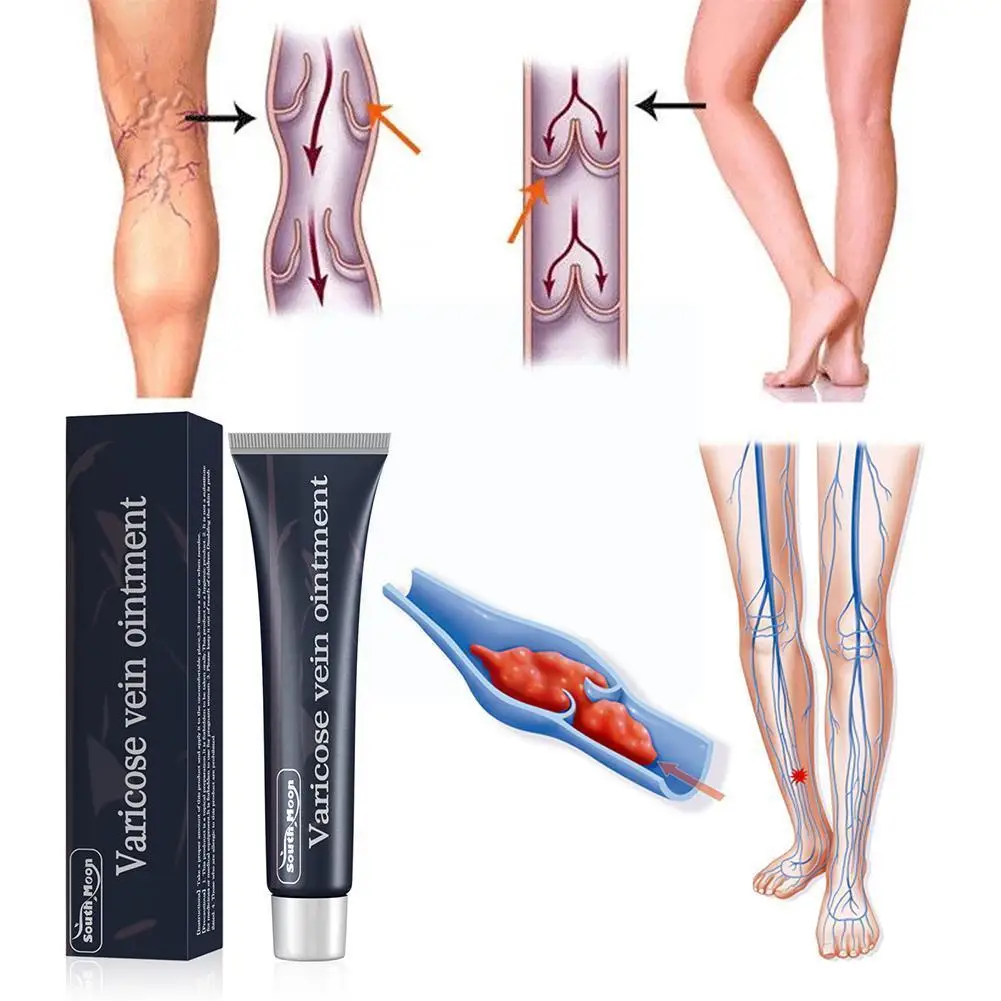 

20g Vein Repair Massage Cream Earthworm Legs Suitable For Vasculitis Phlebitis Lower Limb Swelling Chills Itching Necrosis J0L0