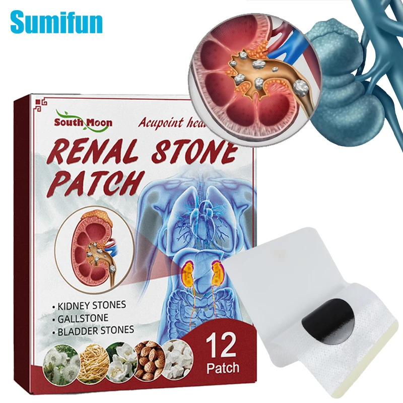 

12Pcs Renal Calculus Removal Plaster Treat Kidney Stones Gallstones Chinesse Medicinal Patch Urolithiasis Pain Relief Sticker