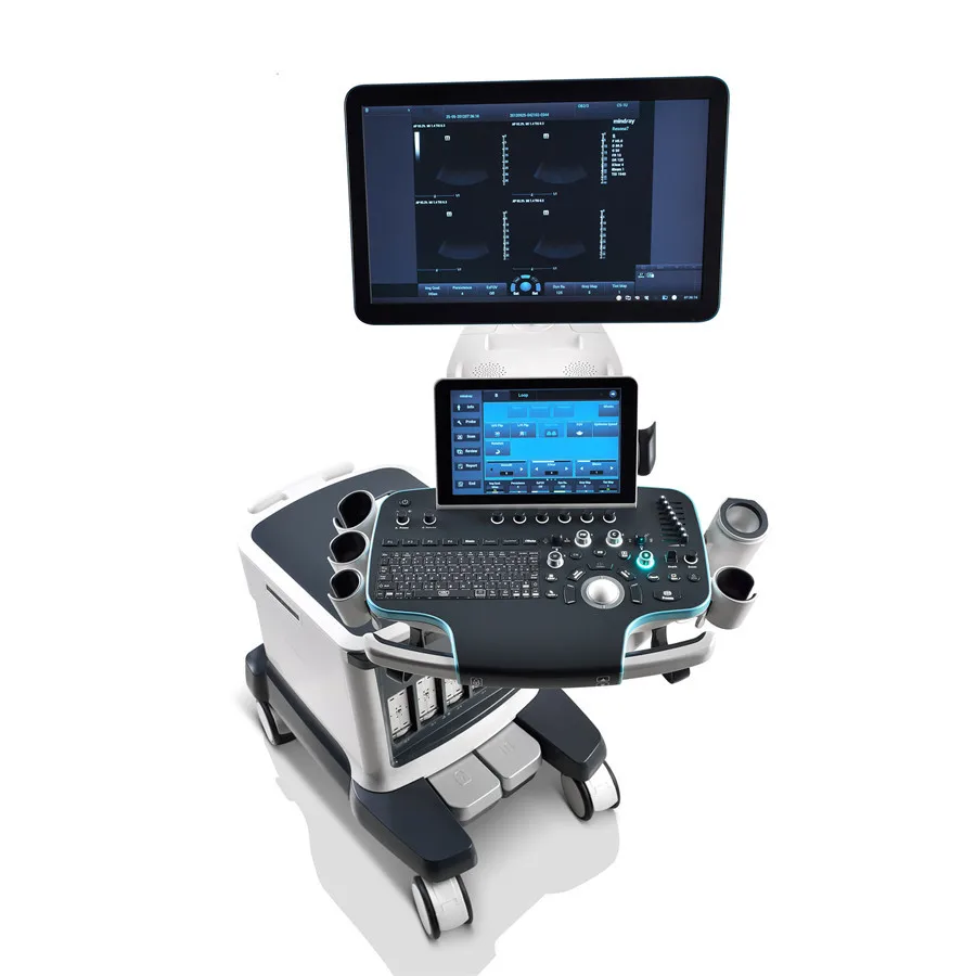 Рисунок 6 - Высококлассная цветная допплеровская