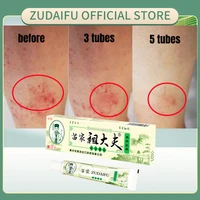 zudaifu skin psoriasis cream no box dermatitis eczematoid eczema ointment treatment psoriasis cream