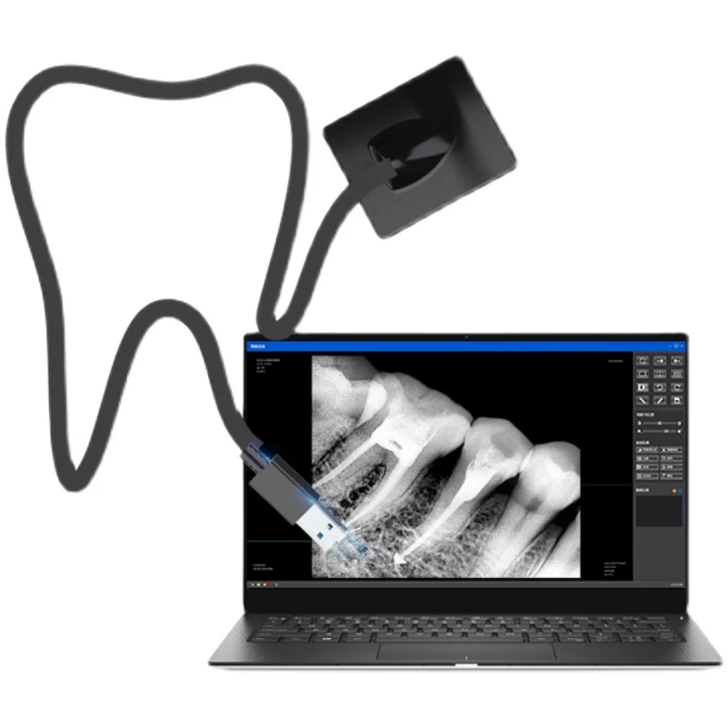 

Large Imaging Size 25x30 Digital Dental Intraoral Xray Sensor