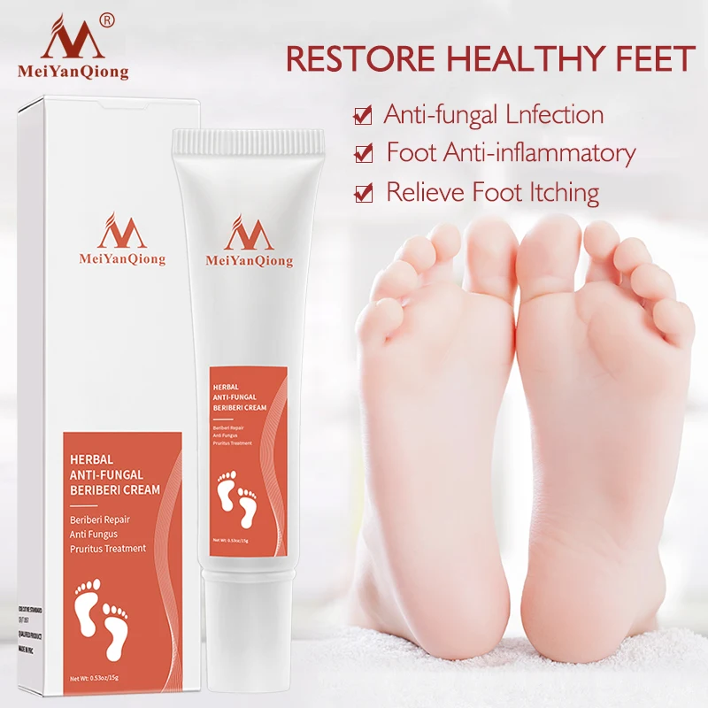 

15g New Products Herbal Anti-fungal Beriberi Cream Fungal Infection Treatment Grey Nails Toenail Fungus Relieve Foot Odor