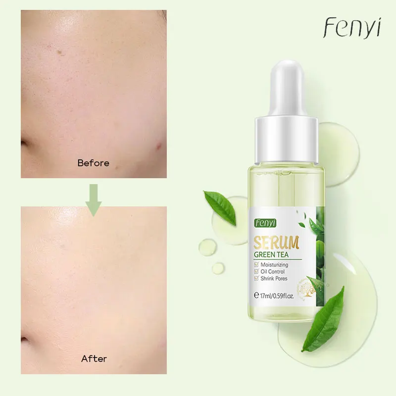 Oil Control Pore Shrink Face Serum Whitening Remove Dark Spots Improve Acne Blackheads Dry Skin Care Korean Cosmetics