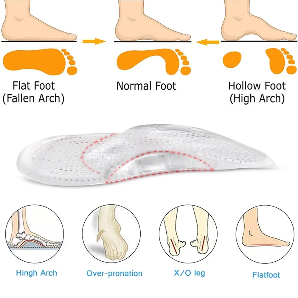 Silicone Gel Arch Support Insoles for Shoes Women Sandals Flat Foot Orthopedic Insoles for Men Plantar Faciitis Relief Shoe Pads