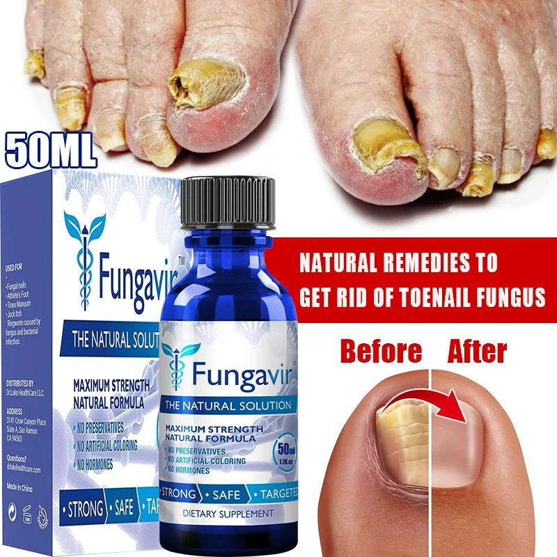 

NEW Powerful Herbal Toe Fungus Care Repair Oil Fungal Growth EXTRA STRONG Nail Fungus Treatment Liquid (10ml/20ml/30ml/50ml)