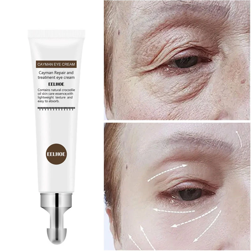 

Anti Aging Eye Cream Removing Periorbital Dark Circles Essence Improve Puffiness Tighten Skin Around Eyes Moisturizing Skin Care
