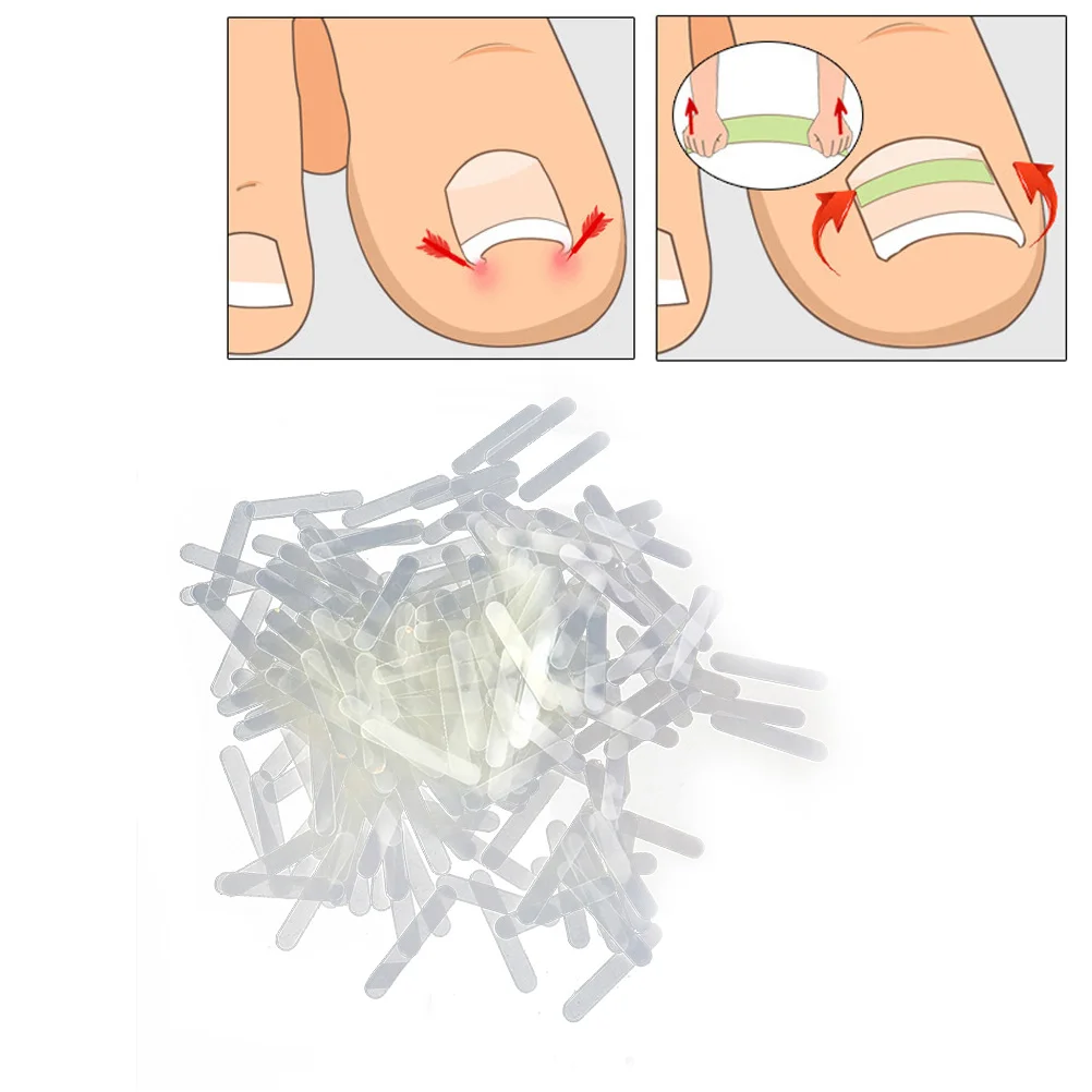 

120pcs Nail Repair Kit Toenail Brace Toenail Patch Toenail Sticker Sticker Patch