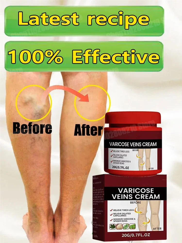 Privates Антибактериальный крем Мошонка Экзема Щедрый Кририс Грибковое инфекция