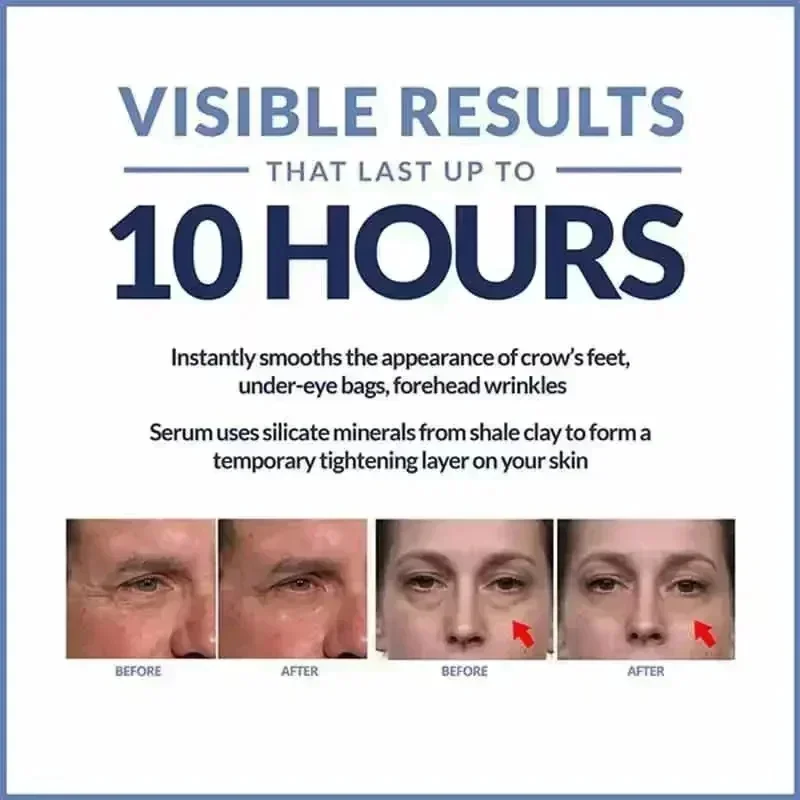 Мгновенный крем для глаз против старения темные круги мешки одутловатость