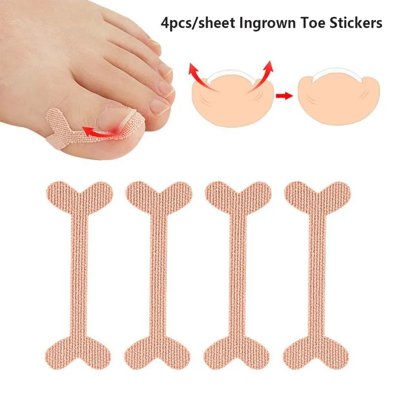 4Pcs/Set Ingrown Toenail Band Aid Relief Pain Paronychia Correction Pedicure Elastic Force Sticker Repair Bandage Toe Nail Care