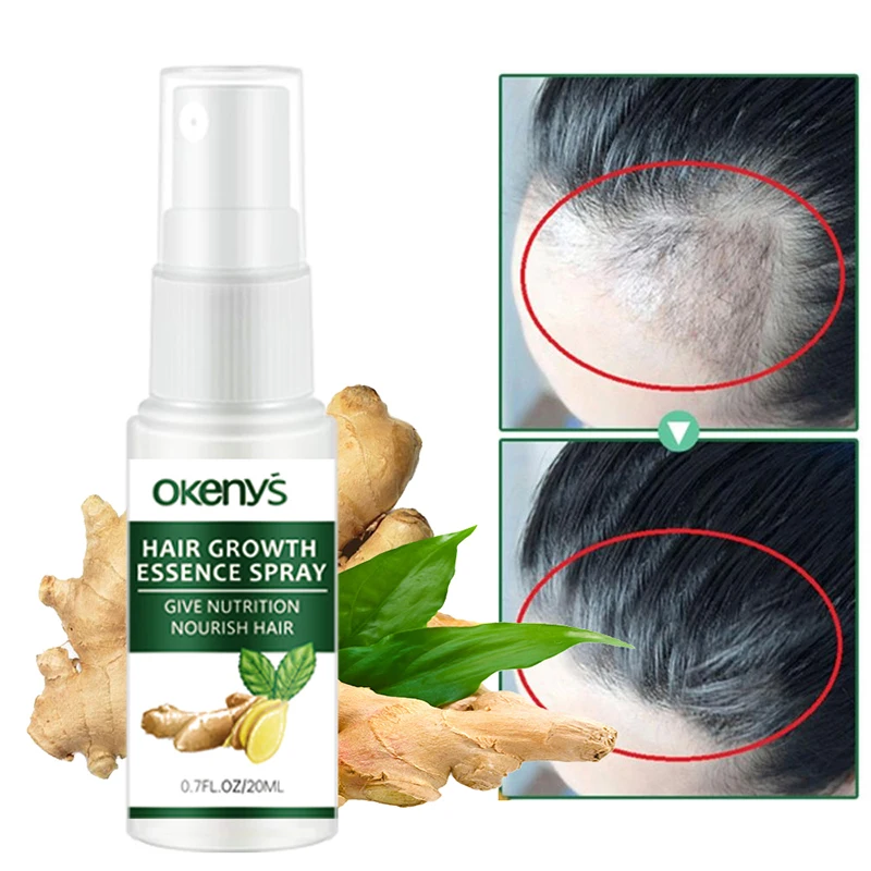

Ginger Hair Growth Spray Serum Anti-hair Loss Essential Oil Product Fast Treatment Prevent Hair Thinning Beauty Health Hair Care