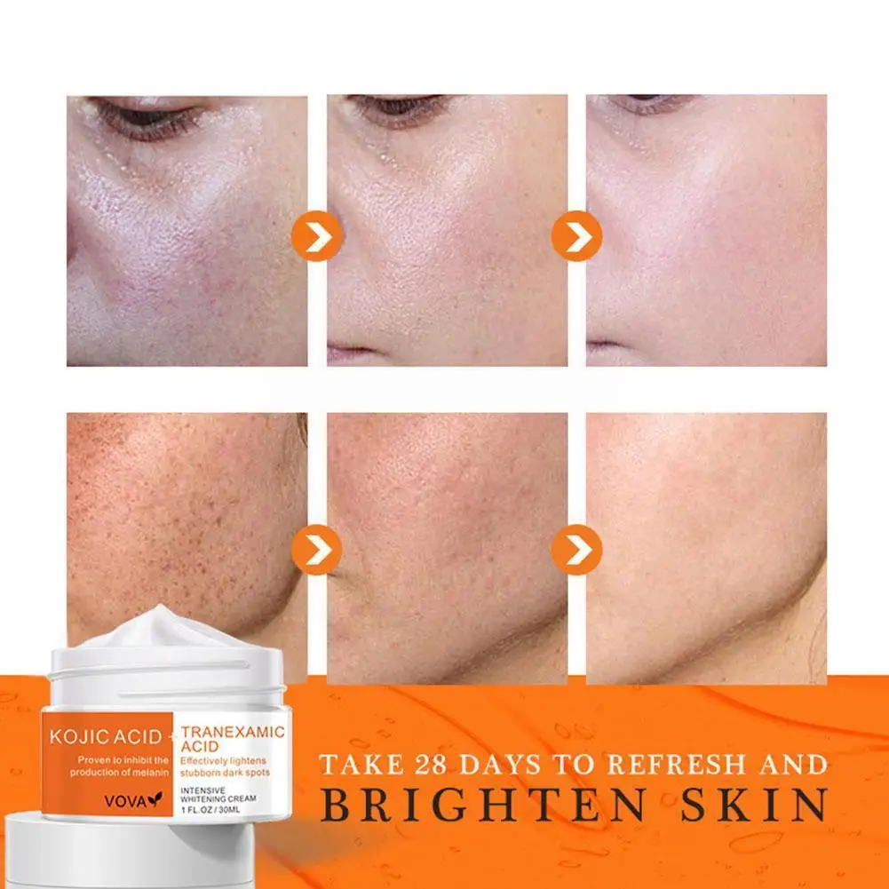 

30g New Whitening Cream Remove Dark Spots Pigment Fade Care Freckle Cream Melanin Melasma Removal Whiten Spot Acne Skin W8u0