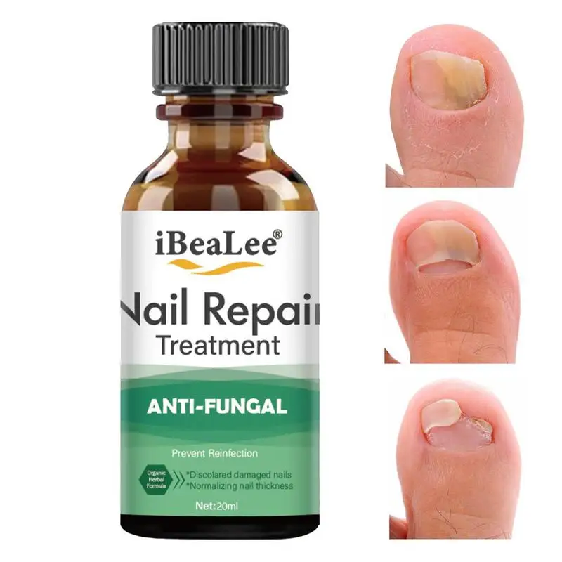 

Toenail Cleaner Liquid Multi Purpose Nail Repair 20ml Fungi Fingernail & Toe Nail Solution Repair Infected Nails Restores Nails