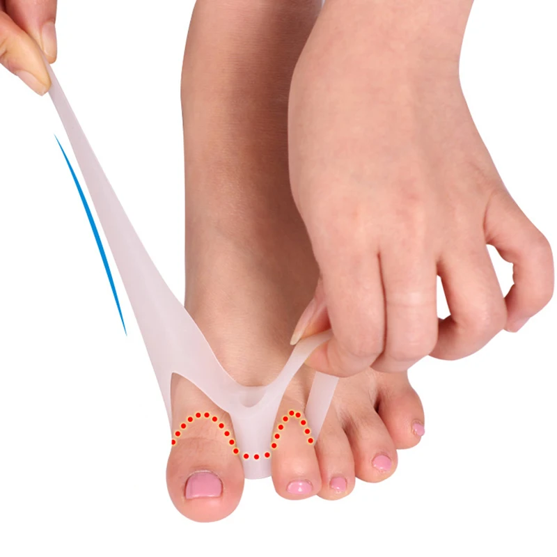 

1 пара разделитель для пальцев ног, корректор вальгусной деформации большого пальца стопы, корректор кости, выпрямитель, инструмент для ухода за ногами