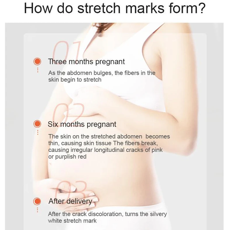 Средство для удаления растяжек, эфирное масло, крем для ухода за кожей ...