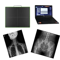 1717 digital wireless x ray flat panel detector for dr