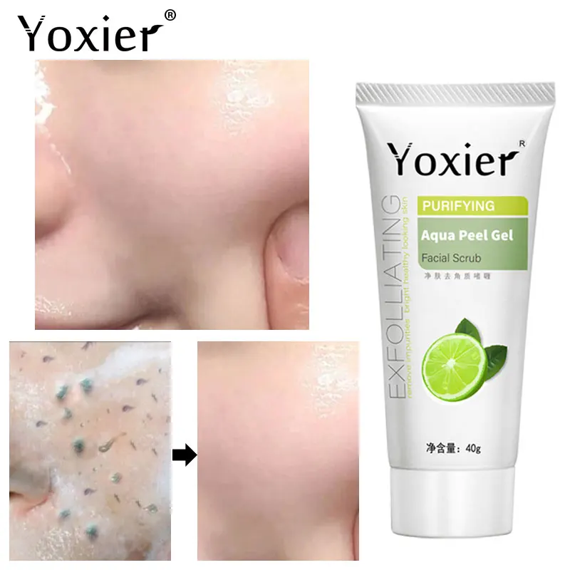 

Exfoliating Gel Has Obvious Exfoliating Effect Deep Cleansing Shrinking Pores Nourishing Moisturizing The Skin Resisting Dullnes