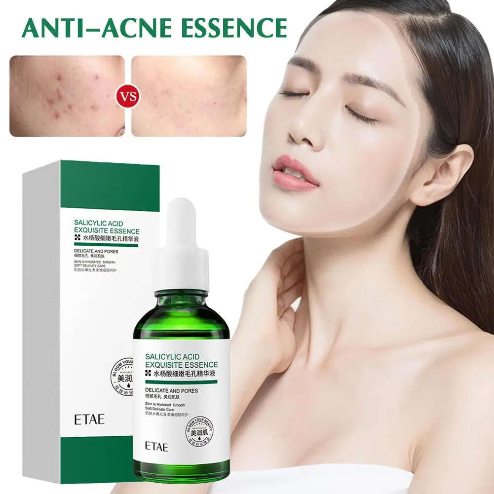 

30ml Anti-acne Essence Salicylic Acid Oil Control Moisturizing And Cleansing Skin Skin Care Solution For Shrinking Pores Q5G1