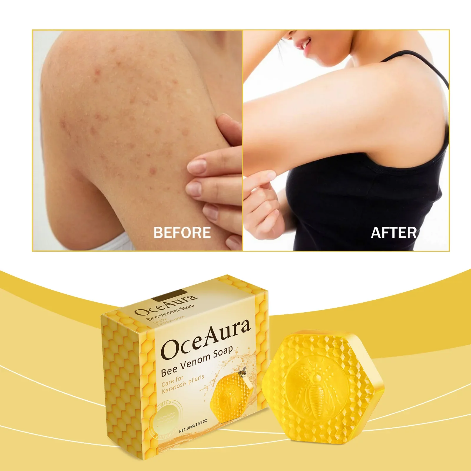 Мыло ручной работы с пчелиным ядом 100 г увлажняющее для ухода за кожей и телом