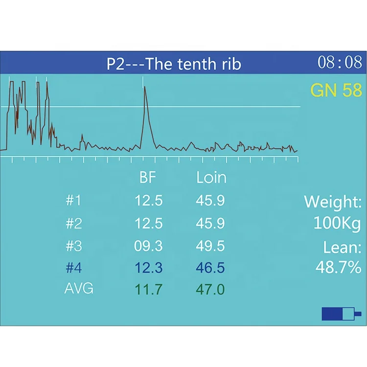 Дешевая электронная ультразвуковая машина со стандартным цифровым механическим