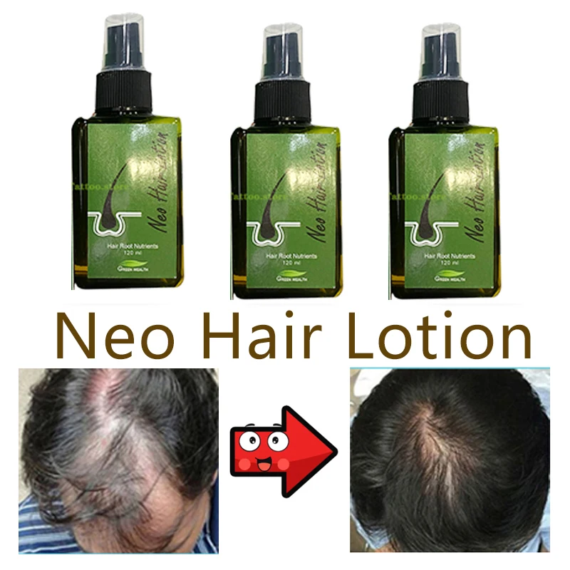 

Лосьон для волос Neo, оригинальный Уход за волосами для мужчин и женщин, Таиланд, против выпадения корней волос, бороды, Восстанавливающий ухо...